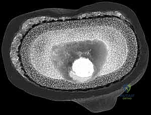 الأستاذ الدكتور محمد هطيف في غرفة العمليات