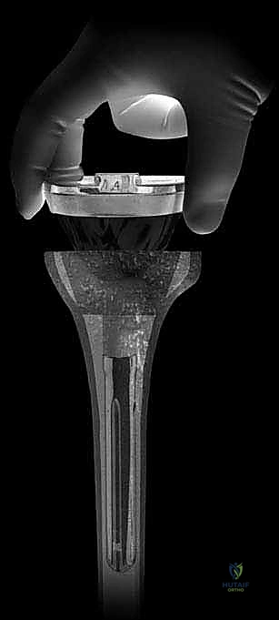 العلاج الطبيعي والتأهيل بعد المراجعة