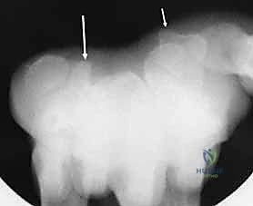 صورة إضافية من العملية