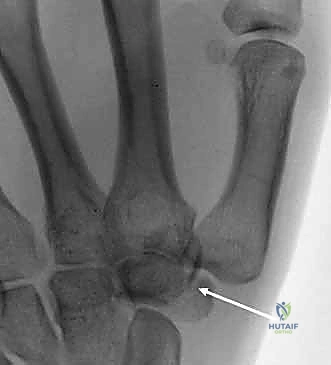 استخدام المنظار الجراحي 4K