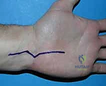 تأكيد التثبيت بالأشعة