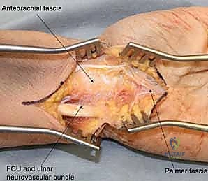 العودة للنشاط الطبيعي