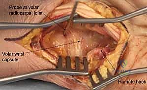 الدكتور محمد هطيف أثناء الجراحة