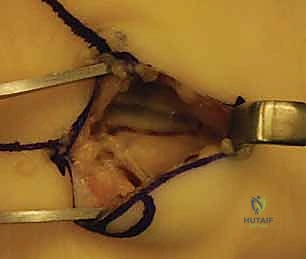 دقة العمل الجراحي