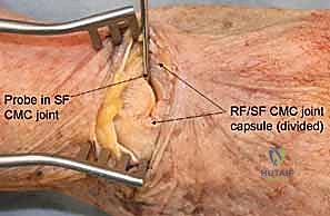 تصوير دقيق لعظام الرسغ