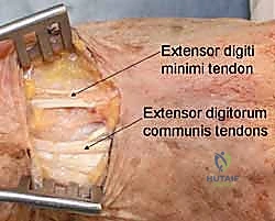 مقارنة تشريحية لعظام الرسغ