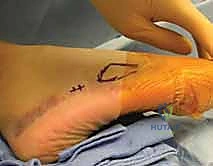 استخدام أحدث التقنيات الجراحية في غرفة العمليات