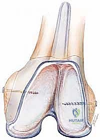 التشريح الحيوي وتأثير فقدان العظم