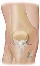 التهاب العظم والغضروف السالخ في الركبة: دليل شامل للتشخيص والعلاج بالمنظار مع الأستاذ الدكتور محمد هطيف