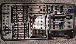 صورة شعاعية توضح المرحلة الرابعة من إبهام القدم المتيبس