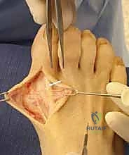 مناقشة خطة العلاج مع المريض بناءً على صور الأشعة السينية