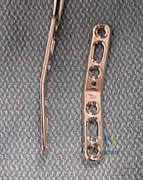 الأستاذ الدكتور محمد هطيف داخل غرفة العمليات المجهزة بأحدث التقنيات