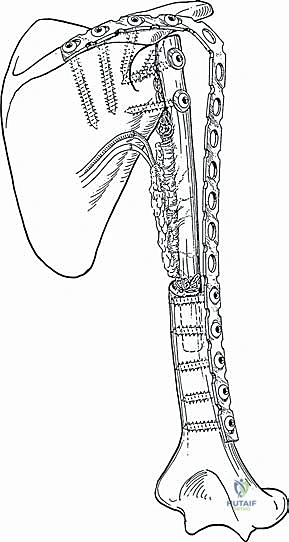 Illustration of ed philadelphia lippincott - Dr. Mohammed Hutaif