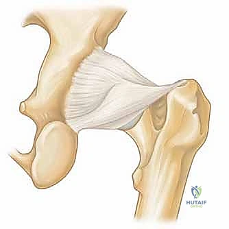 صورة توضيحية لـ منظار الورك: دليلك الشامل لعلاج آلام مفصل الورك المعقدة مع الأستاذ الدكتور محمد هطيف في صنعاء