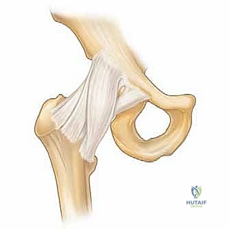 صورة توضيحية لـ منظار الورك: دليلك الشامل لعلاج آلام مفصل الورك المعقدة مع الأستاذ الدكتور محمد هطيف في صنعاء