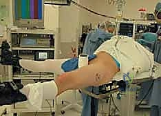 استخدام الأدوات الدقيقة عبر المنظار