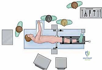 تفاصيل دقيقة داخل مفصل الورك بالمنظار