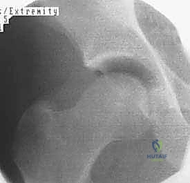 تقييم الحالة داخل غرفة العمليات