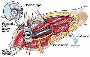 فحص سريري للمريض لتحديد مكان الألم والتورم