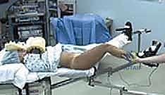 الاصطدام الفخذي الحقي