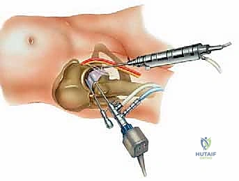 خيارات العلاج التحفظي والجراحي