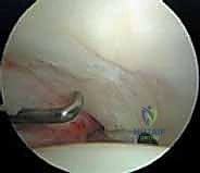 تقنيات المناظير الحديثة