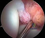 Illustration of soft tissue pathology - Dr. Mohammed Hutaif