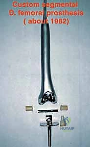 استئصال الورم ككتلة واحدة