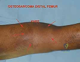 التحقق من الهوامش الجراحية
