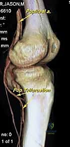 اختبار حركة المفصل