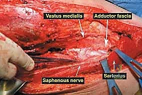 المشي بمساعدة العكازات