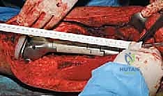 تحليل صور الرنين المغناطيسي