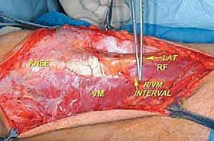 استخدام التقنيات الحديثة