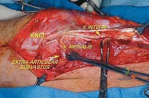 الفحص السريري للركبة