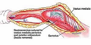 استعادة التوازن