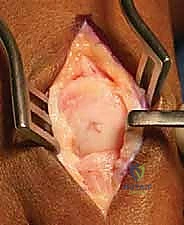 استخدام أدوات التثبيت المؤقت لضبط الزوايا