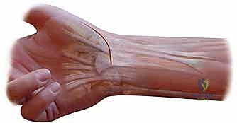 صورة طبية: علاج عدم استقرار مفصل إبهام اليد: تثبيت الأربطة جراحياً مع الأستاذ الدكتور محمد هطيف