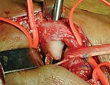 التشخيص الإشعاعي والسريري لمفصل الإبهام