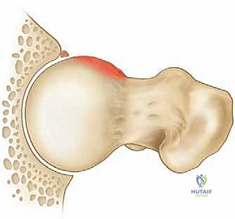 توضيح الشفا الحقي والغضاريف المحيطة