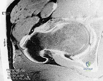 استخدام أحدث التقنيات الطبية في عيادة الدكتور هطيف