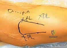 صور الأشعة السينية والرنين المغناطيسي لتشخيص الورك