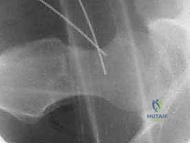 الأستاذ الدكتور محمد هطيف أثناء تقييم حالة مريض