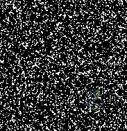 Glenohumeral Arthroplasty for Irreparable Rotator Cuff Deficiency: An Intraoperative Masterclass