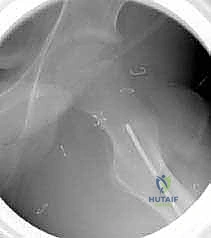 التحقق من التثبيت بالأشعة السينية أثناء الجراحة