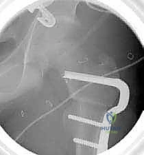 العلاج الطبيعي والتأهيل بعد الجراحة