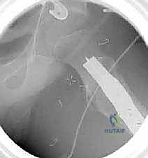 الفحص السريري وتقييم زاوية الدوران