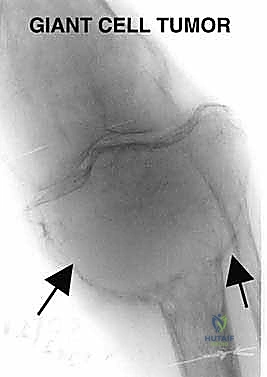 تفاصيل جراحية دقيقة