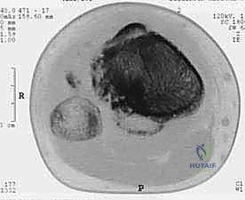 صورة توضيحية للخيارات العلاجية