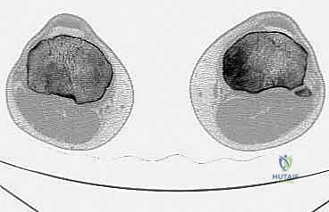 تقييم الأعراض السريرية