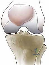 التشريح الدقيق لمفصل الركبة وآلية البسط